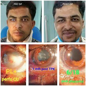 Eye Specialist Indore