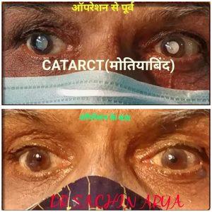 Best Eye Hospital For Eye Cosmetic Surgery